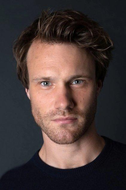 Hugh Skinner - Actor Profile Photo