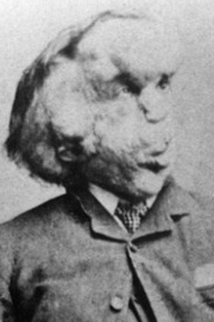 Joseph Merrick - Actor Profile Photo