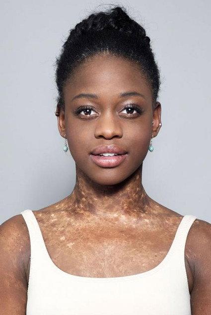 Michaela DePrince - Actor Profile Photo