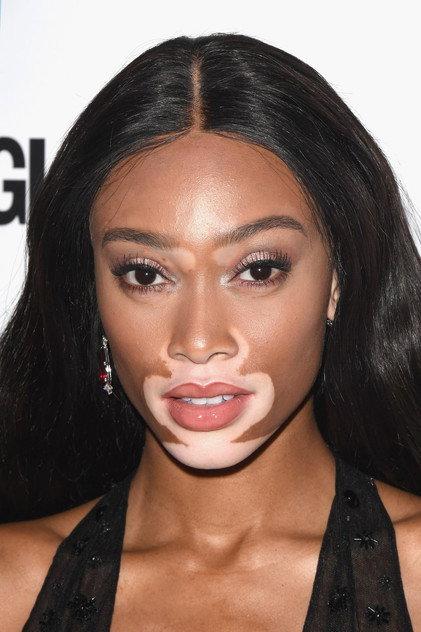 Winnie Harlow - Actor Profile Photo