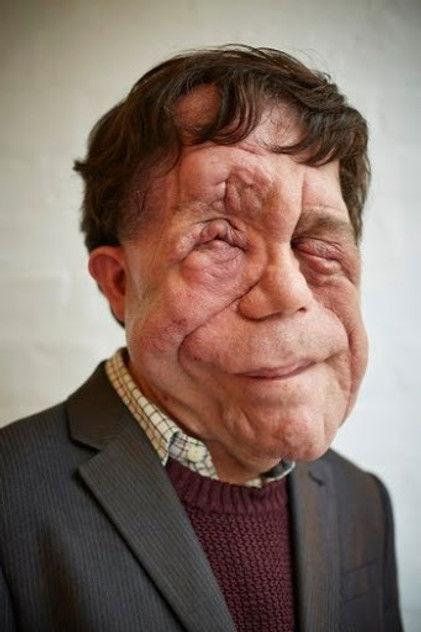 Adam Pearson - Actor Profile Photo