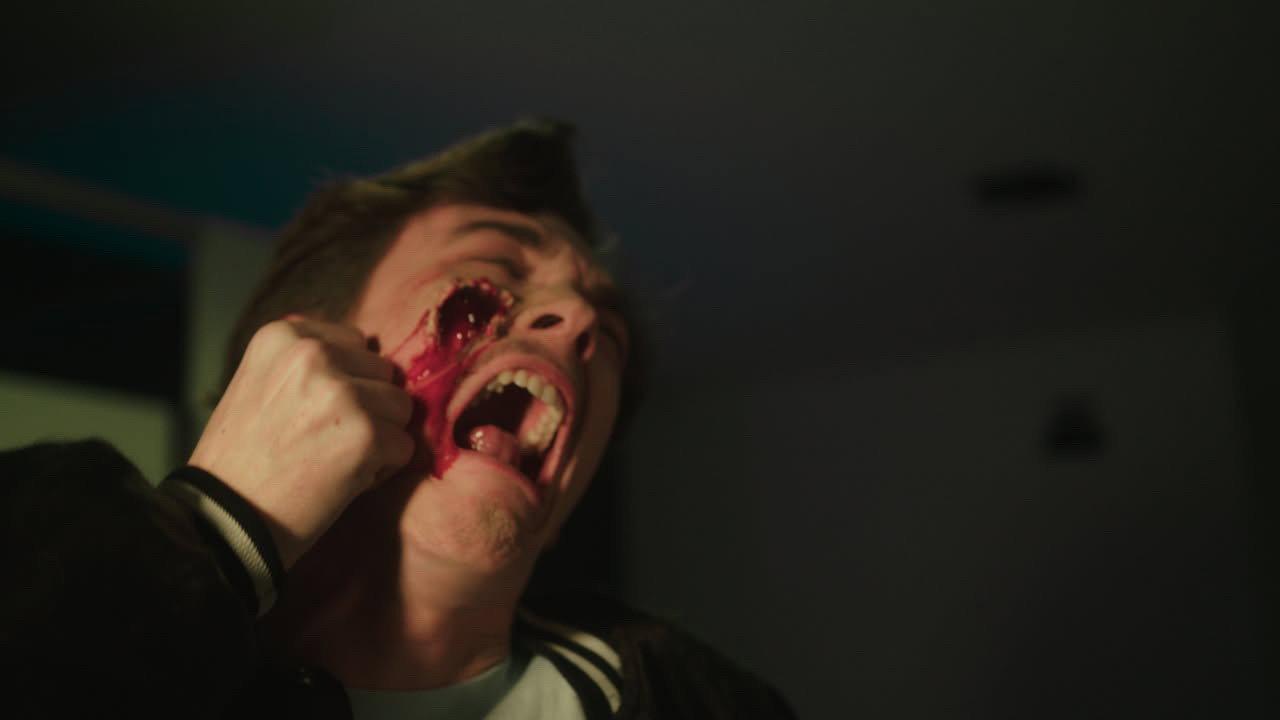 Pimple Patch 2025 movie scene