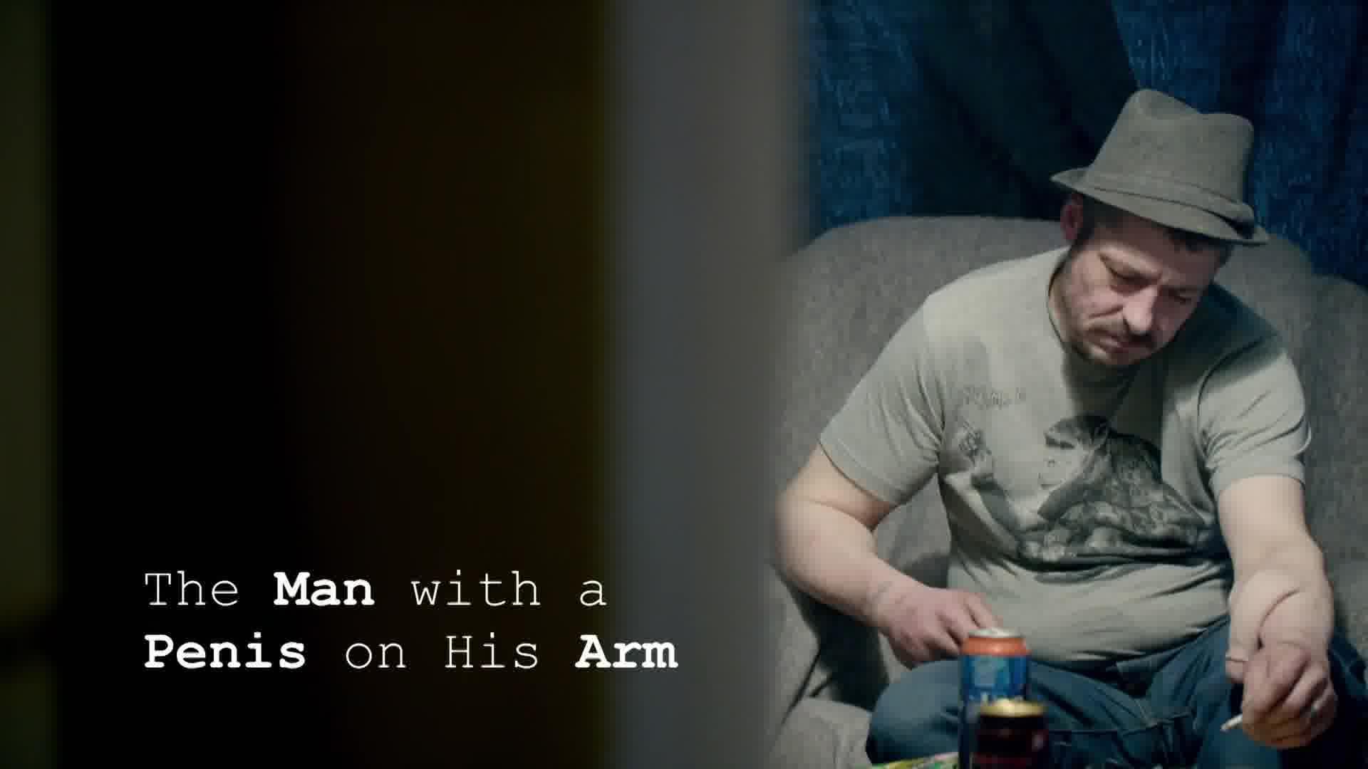 The Man With a Penis on His Arm 2022 movie scene