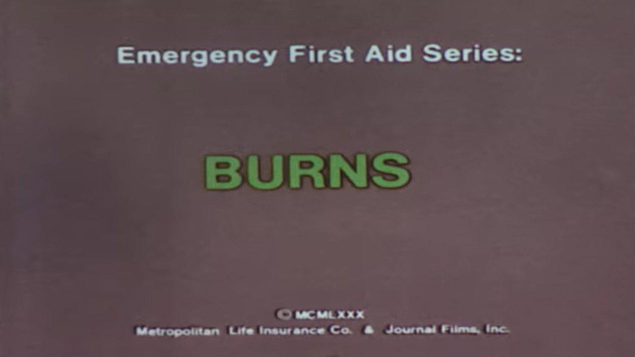 Emergency First Aid Series: Burns 1980 movie scene