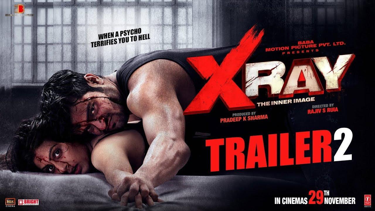 X Ray: The Inner Image 2019 movie scene
