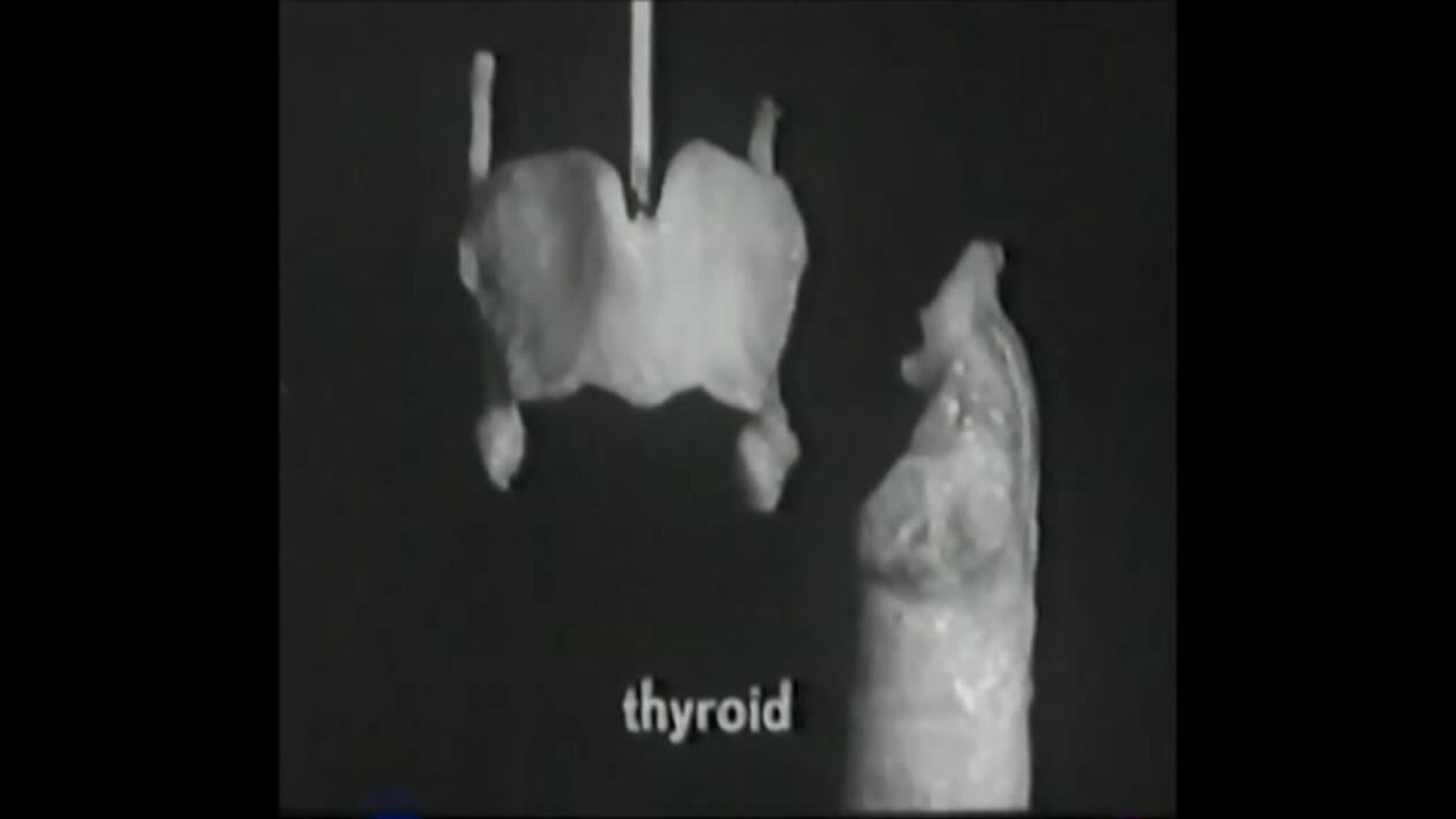 Voice Production: The Vibrating Larynx 1960 movie scene