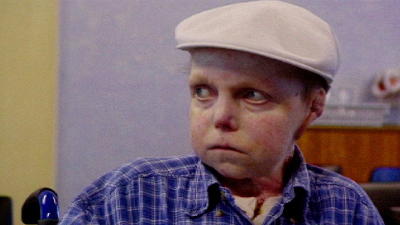 The Boy Whose Skin Fell Off 2004 movie scene