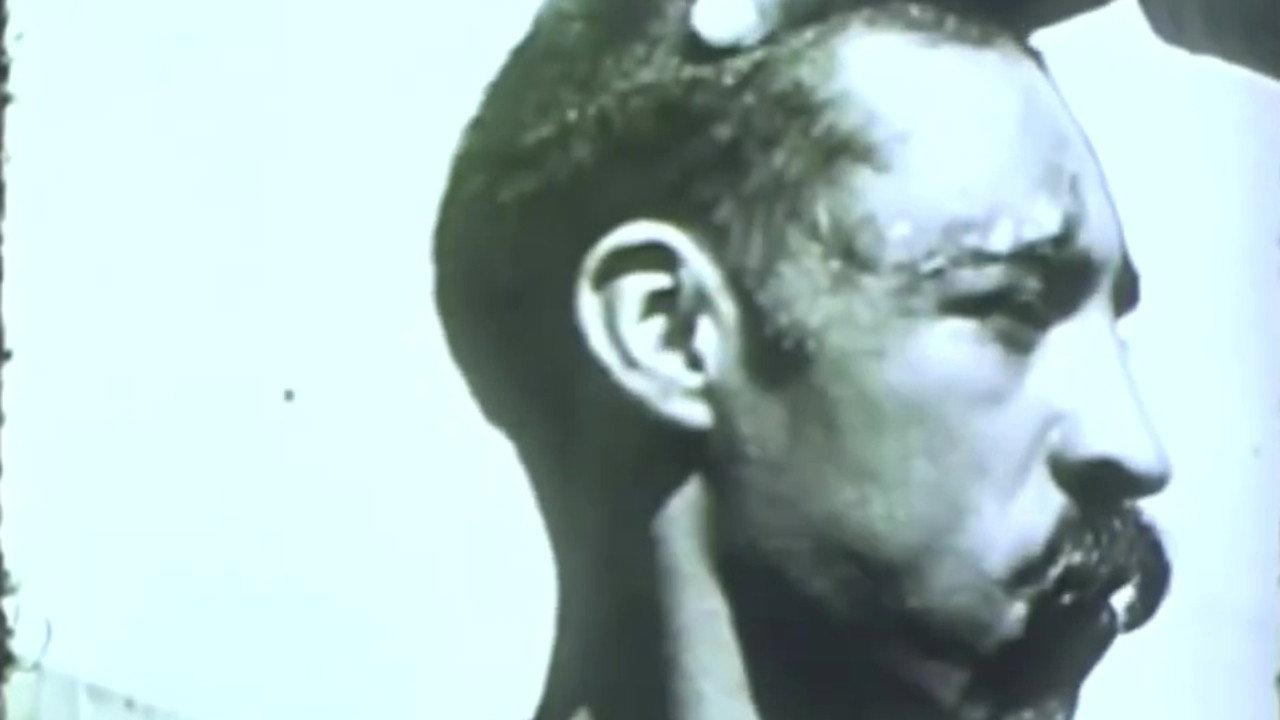 Rabies in a Human Patient 1955 movie scene