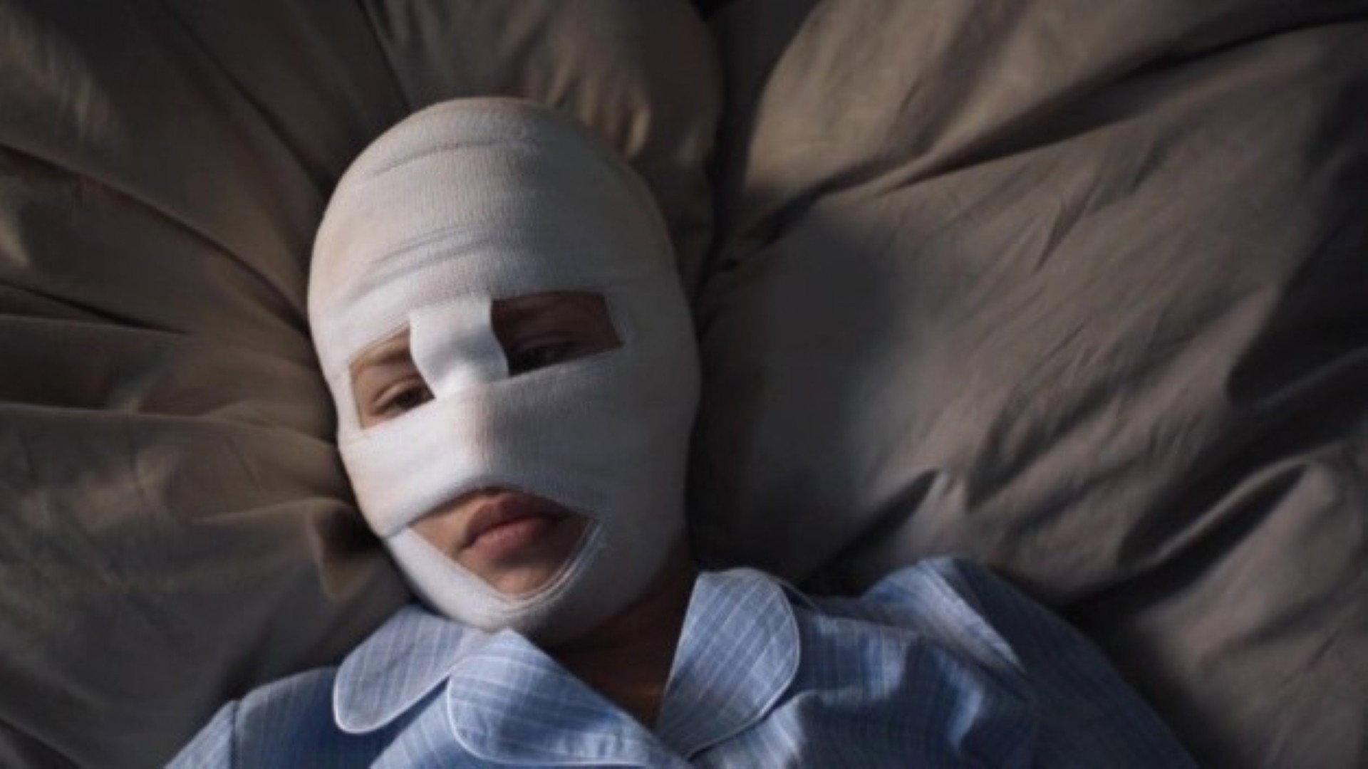 Bandaged 2009 movie scene