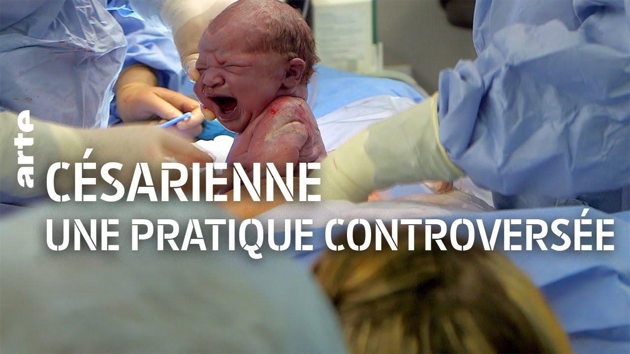 The C-Section Controversy 2016 movie scene