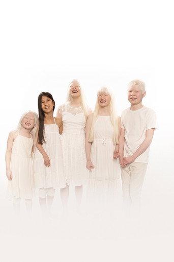 Born with Albinism (2021) poster