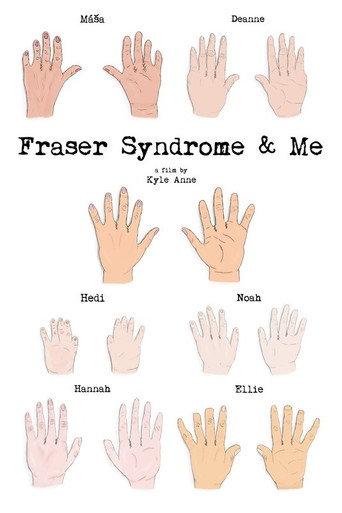 Fraser Syndrome & Me (2018) poster