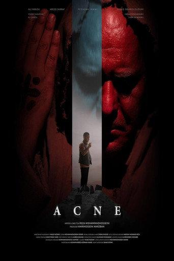 Acne (2025) poster