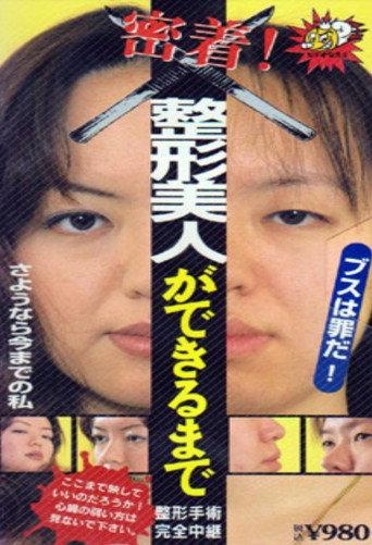 Until You Have  Beauty: Plastic Surgery (1995) poster