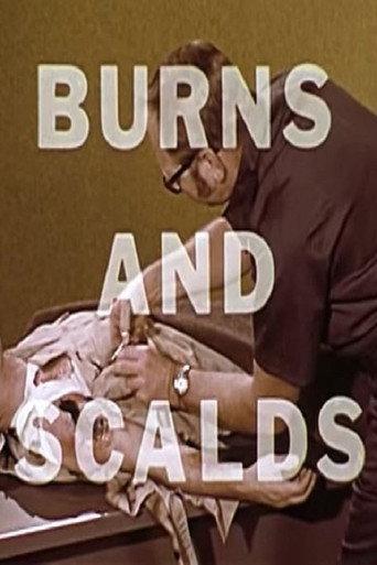 Burns And Scalds (1970) poster