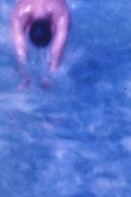 Healing Process 1974 official movie poster