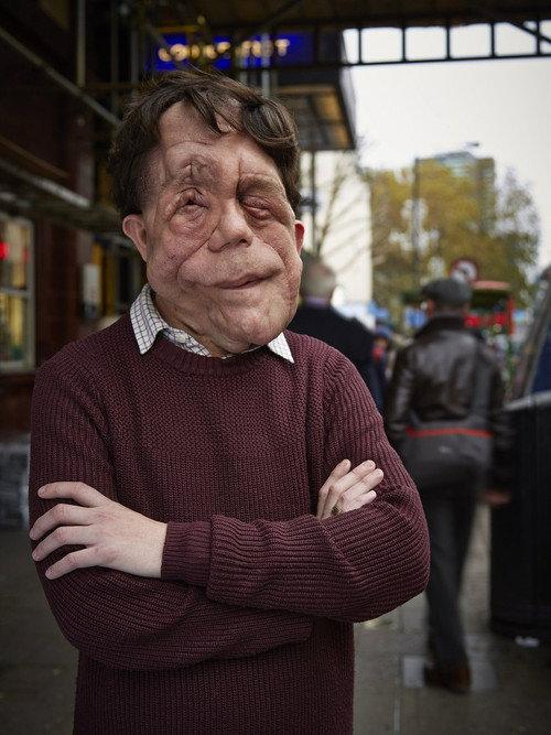 The Ugly Face of Disability Hate Crime 2015 official movie poster