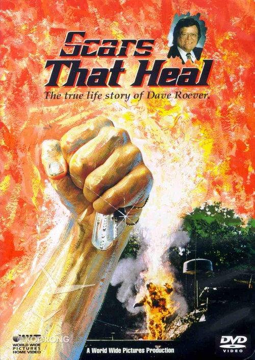 Scars That Heal: The Dave Roever Story 1993 official movie poster