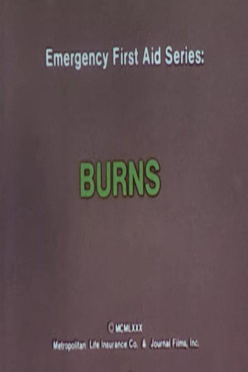 Emergency First Aid Series: Burns 1980 official movie poster