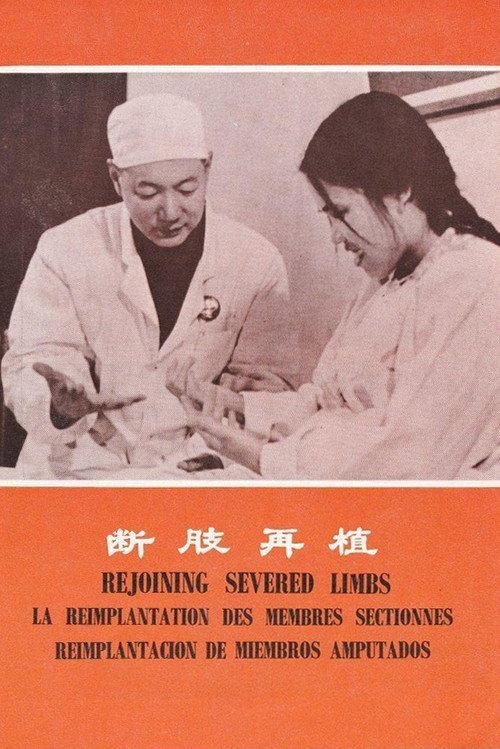Rejoining Severed Limbs 1972 official movie poster