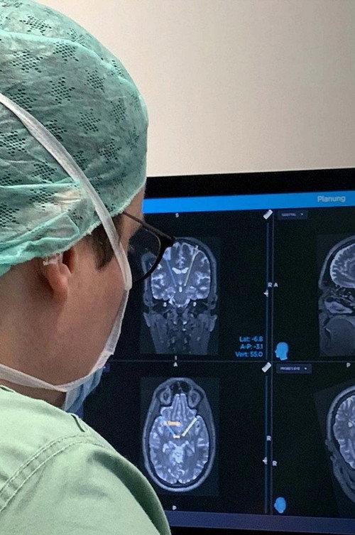 Gehirn unter Strom - Hilfe bei Depression, Epilepsie und Parkinson? 2026 official movie poster