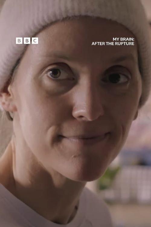 My Brain: After the Rupture 2025 official movie poster