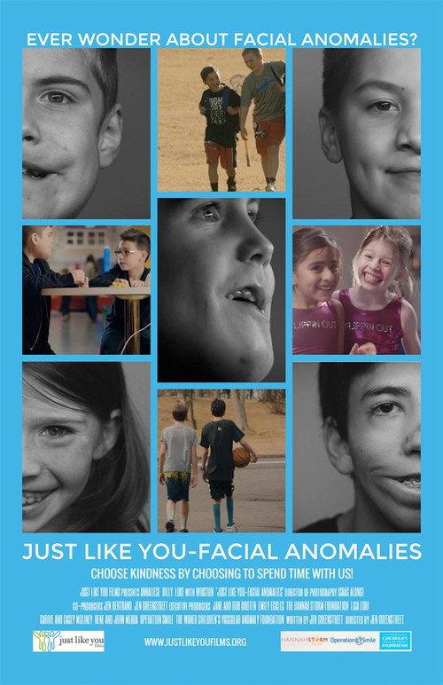 Just Like You: Facial Anomalies 2017 official movie poster