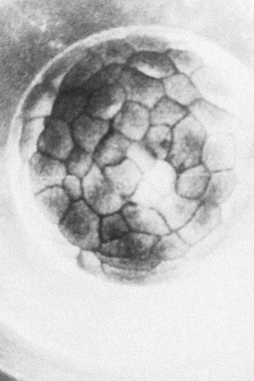 Gestation of the Ovum 1924 official movie poster