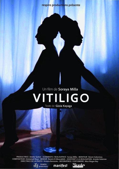Vitiligo 2019 official movie poster