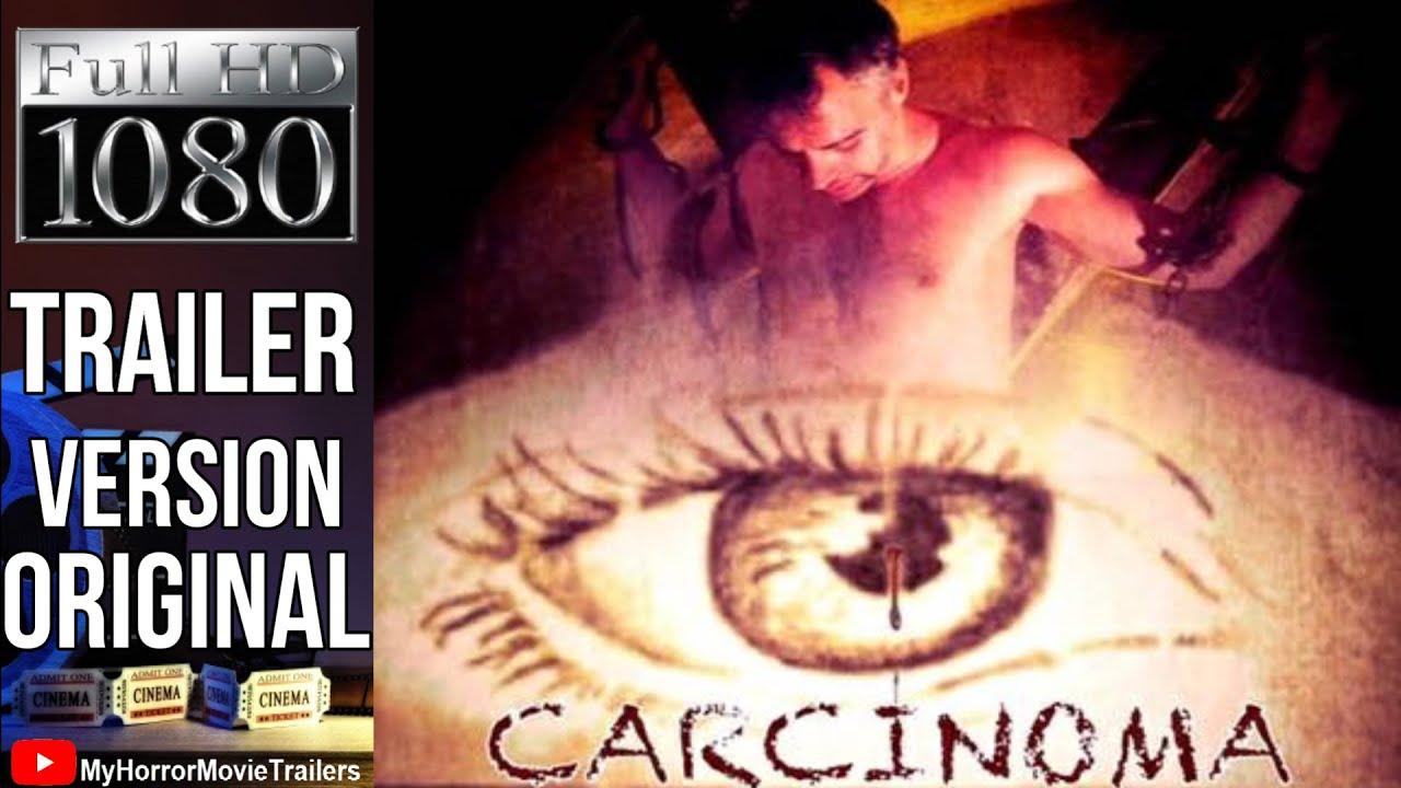 Carcinoma Trailer
