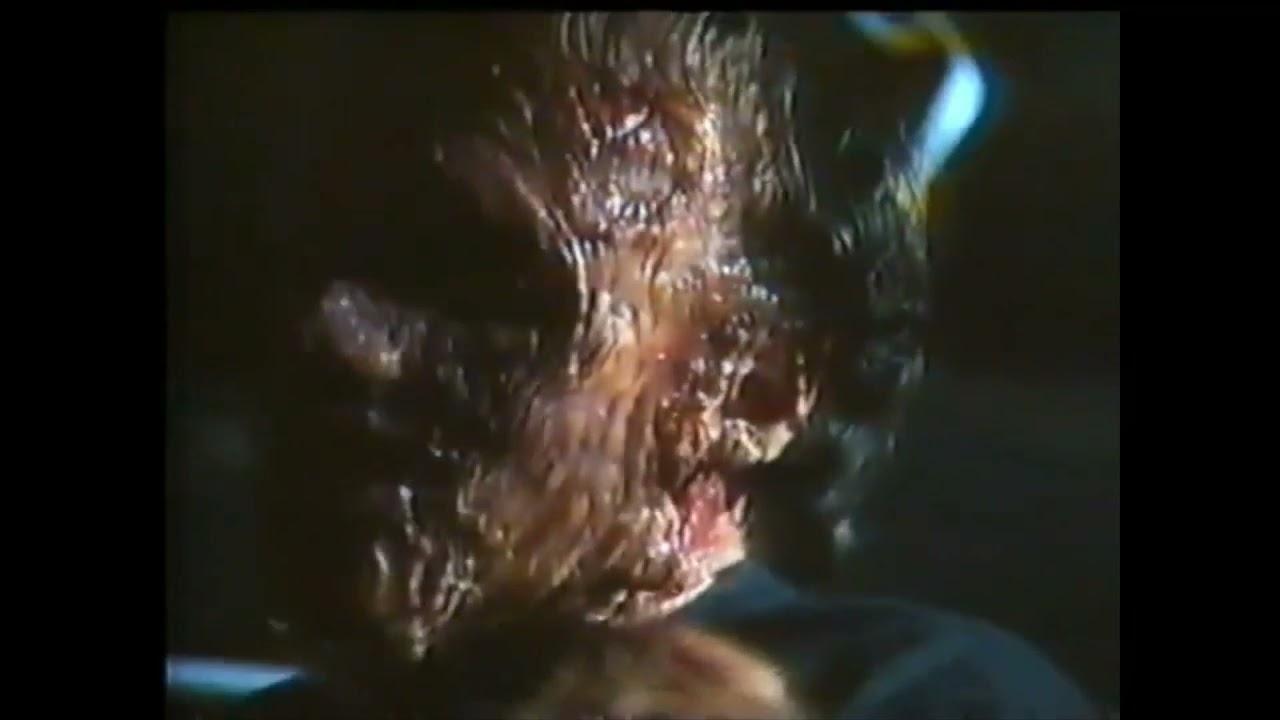 Charly: Days of Blood Trailer