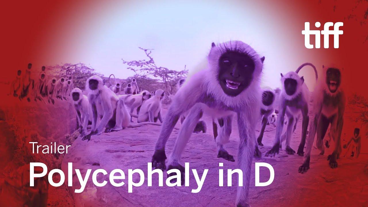 Polycephaly in D Trailer