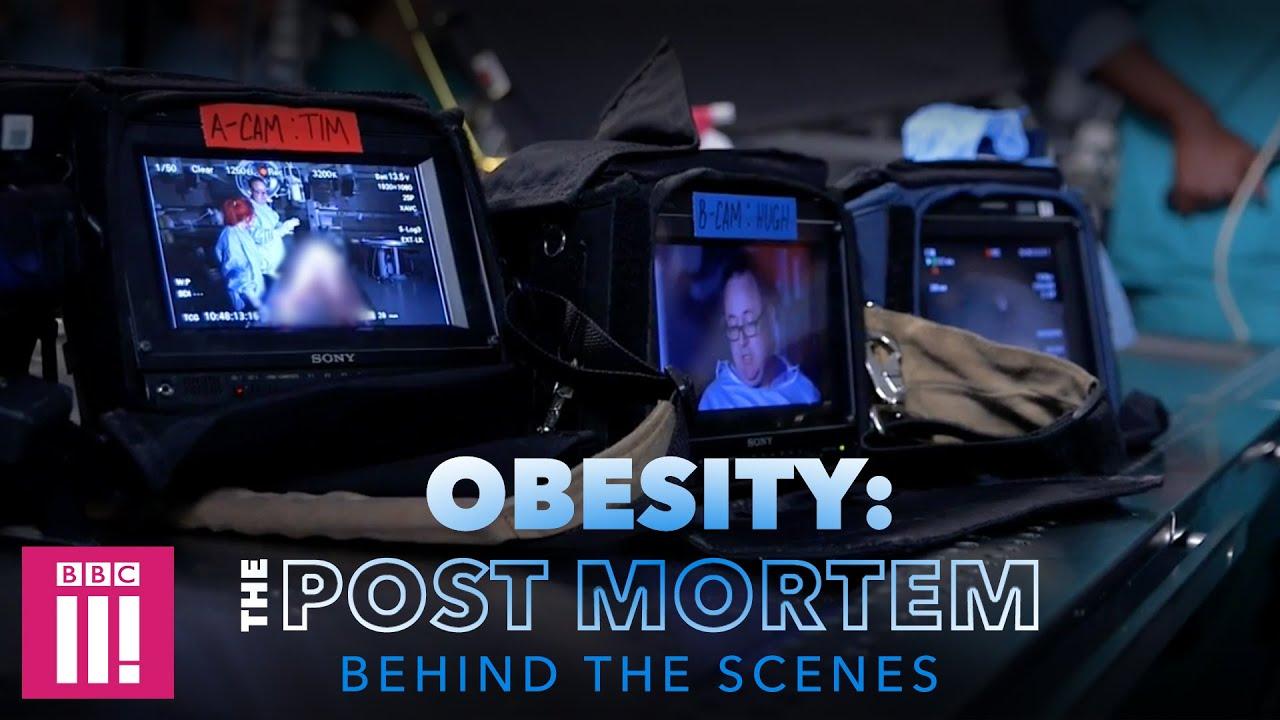 Obesity: The Post Mortem Trailer
