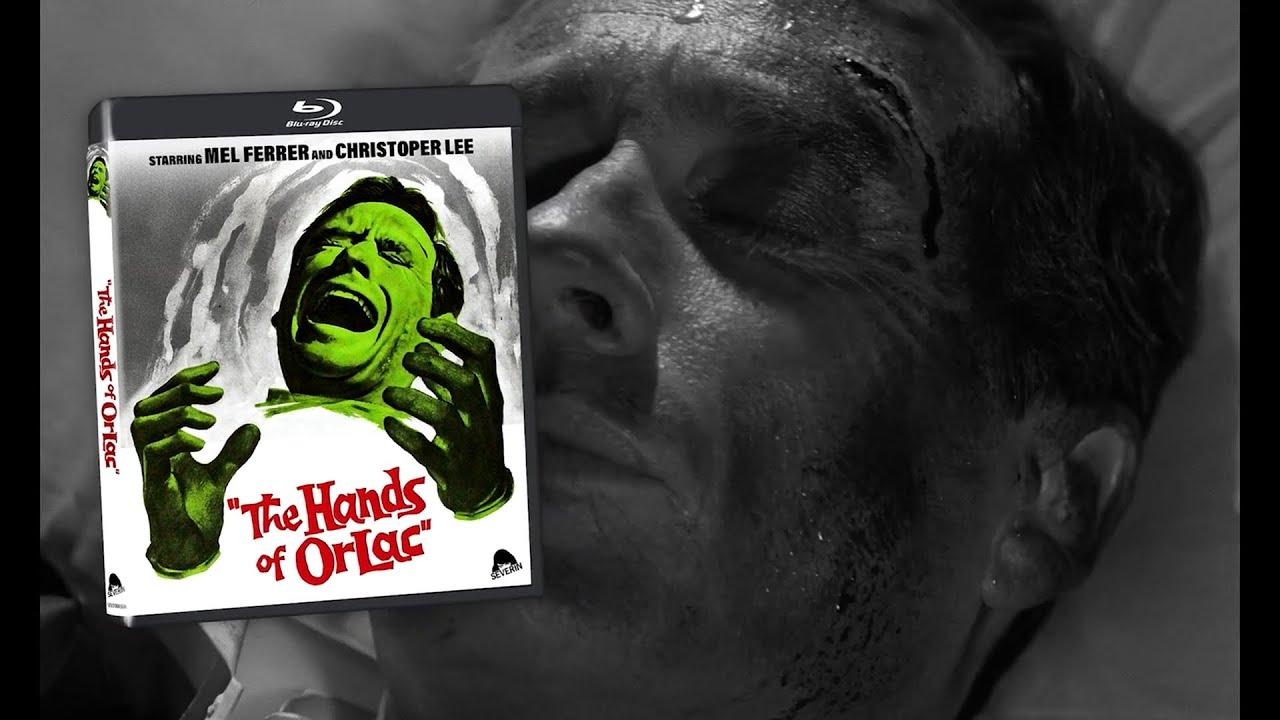 The Hands of Orlac Trailer