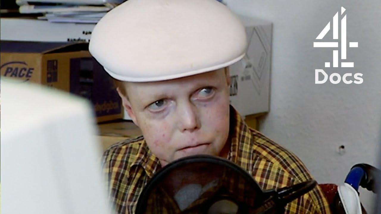 The Boy Whose Skin Fell Off Trailer