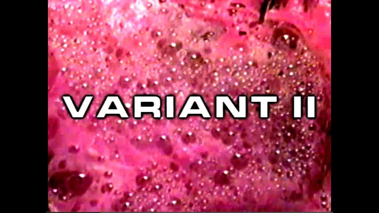Variant II Trailer