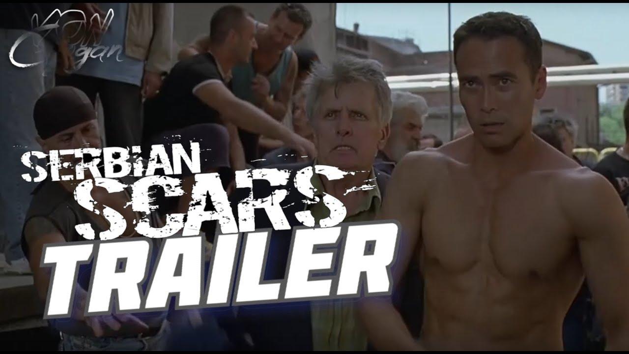 Serbian Scars Trailer