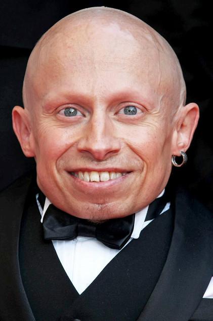 Verne Troyer - Actor Profile Photo
