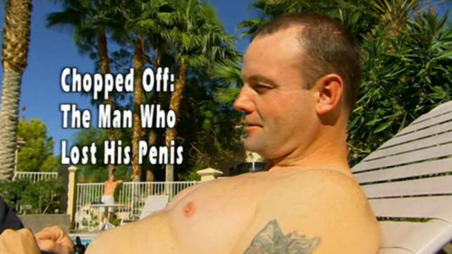 Chopped Off: The Man Who Lost His Penis 2006 movie scene