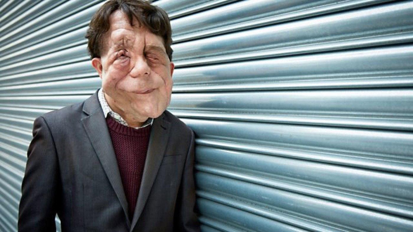 The Ugly Face of Disability Hate Crime 2015 movie scene