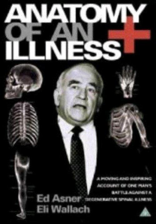 Anatomy of an Illness 1984 official movie poster