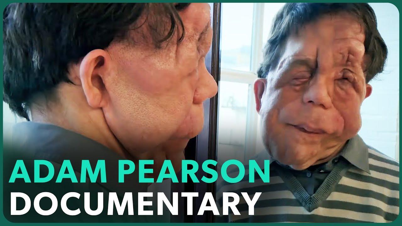The Ugly Face of Disability Hate Crime Trailer