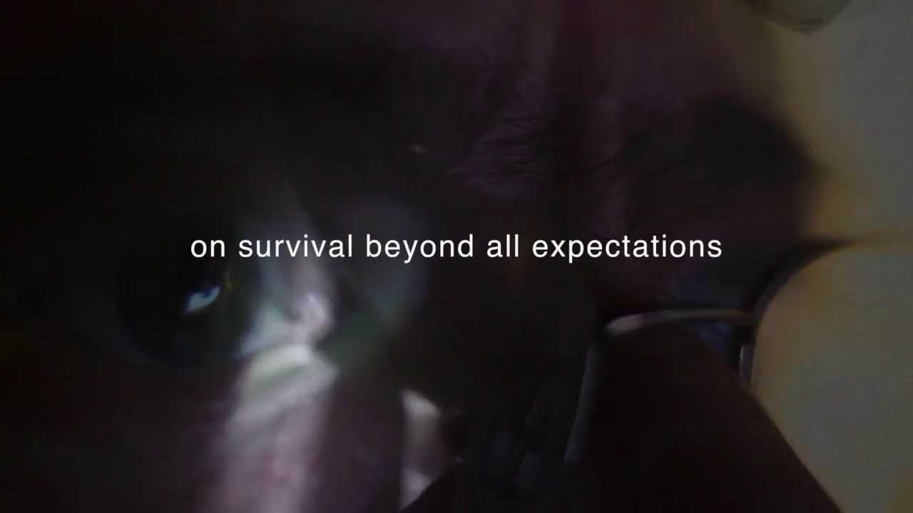What Now? Remind Me Trailer